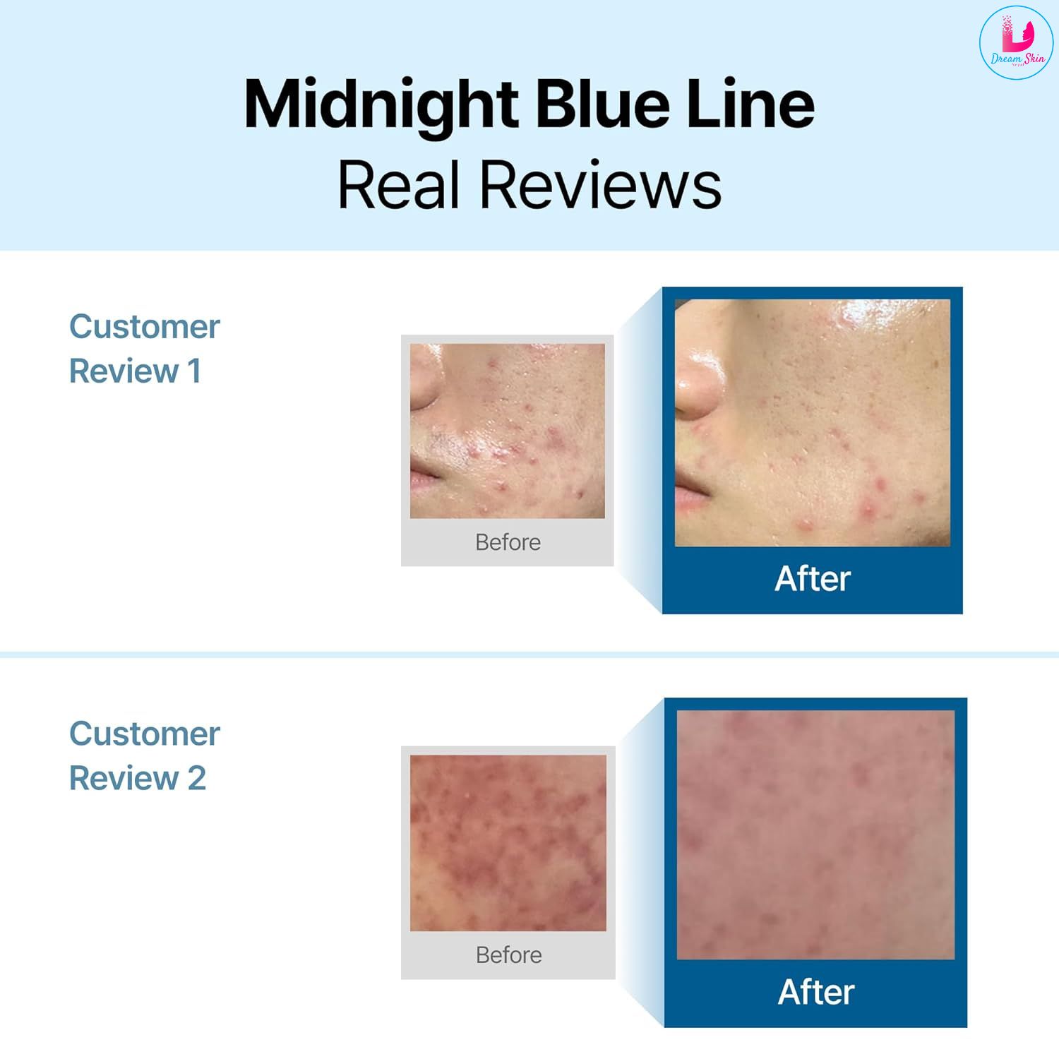 Dear Klairs Midnight Blue Calming Cream (60ml)